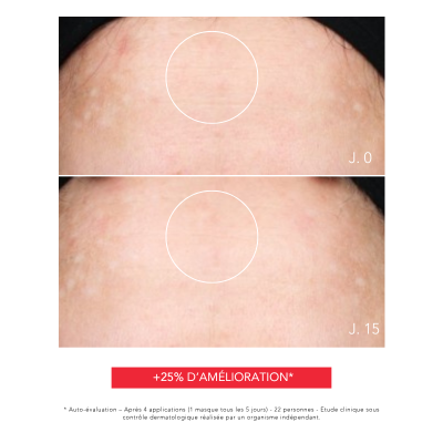 Hyaluronic Masque, Masque hydratant et apaisant, Résultats prouvés, Laboratoire ENEOMEY