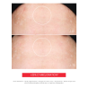 Hyaluronic Masque, Masque hydratant et apaisant, Résultats prouvés, Laboratoire ENEOMEY