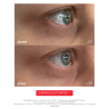 EYE C+, Soin regard anti-âge revitalisant Programmes anti-âge| Laboratoire ENEOMEY
