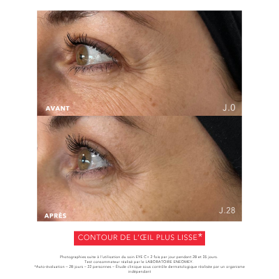 EYE C+ Soin regard Anti-âge | Résultats prouvés | Laboratoire ENEOMEY