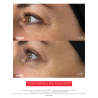 EYE C+ Soin regard Anti-âge | Résultats prouvés | Laboratoire ENEOMEY