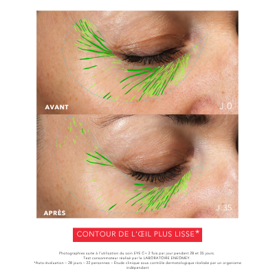 EYE C+ Soin regard Anti-âge | Résultats prouvés | Laboratoire ENEOMEY