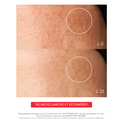 LIGHT RENEW GEL, Gel de nuit dépigmentant régulateur | Résultats prouvées