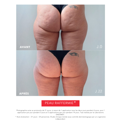 PERFECT BODY 30, Lait Corporel Raffermissant | Résultats Prouvés | Laboratoire ENEOMEY