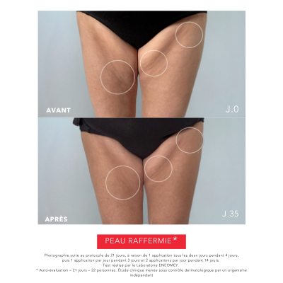 PERFECT BODY 30, Lait Corporel Raffermissant | Résultats Prouvés | Laboratoire ENEOMEY