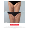 PERFECT BODY 30, Lait Corporel Raffermissant | Résultats Prouvés | Laboratoire ENEOMEY