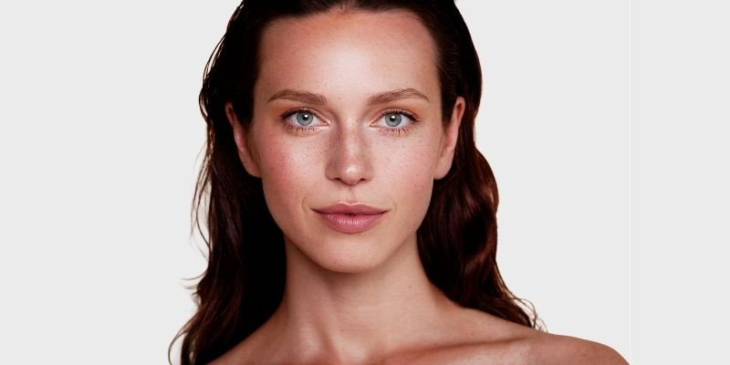 Acne, Excess sebum
